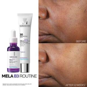 MELA B3 DARK SPOT SERUM WITH MELASYL™ + NIACINAMIDE